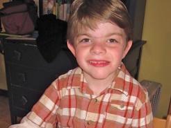 Ben, a child with Cornelia de Lange Syndrome (CdLS)
